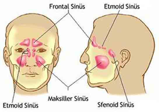 Sfenoid Sins